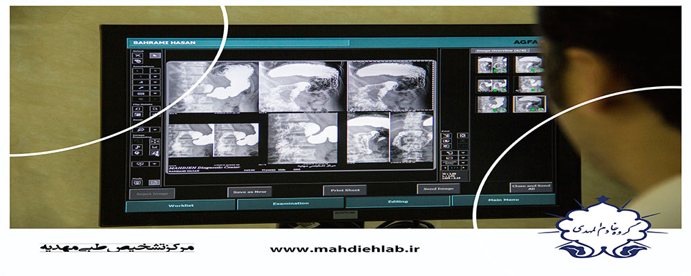 انجام انواع سونوگرافي در مركز سونوگرافي مهديه